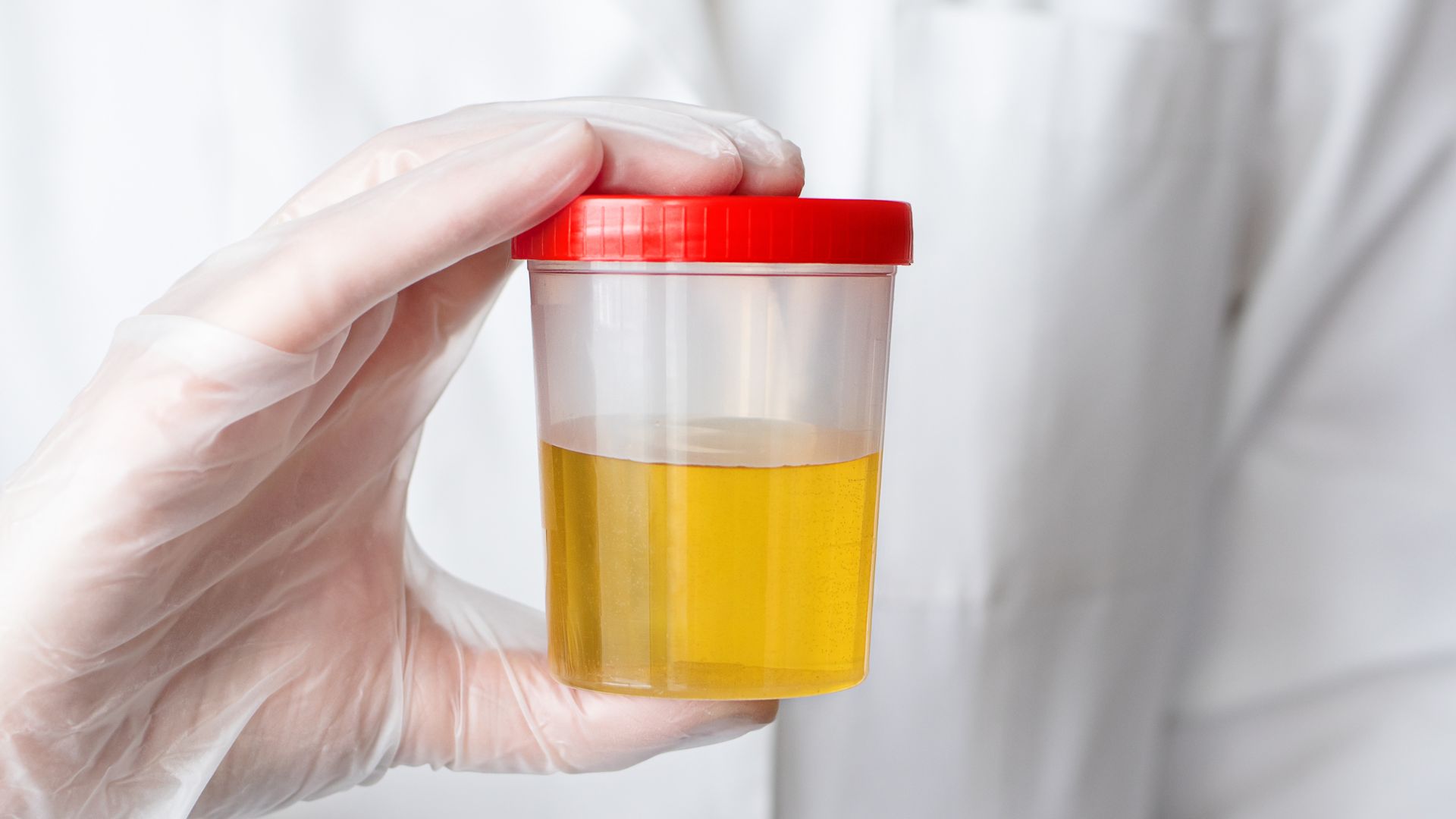 What are Urine Specimen Collection Procedures for a DOT Drug Test?